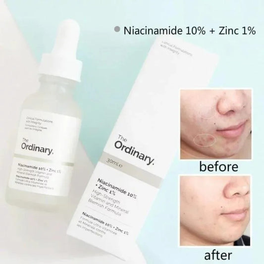 Revitalize Your Skin with 1 Pcs 70% Niacinamide Serum - Anti-Acne